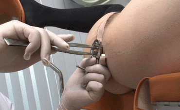 ロリ系エロGIF画像｜肛門診療科で女の子のお尻の穴を調べてる感じのエロギフ